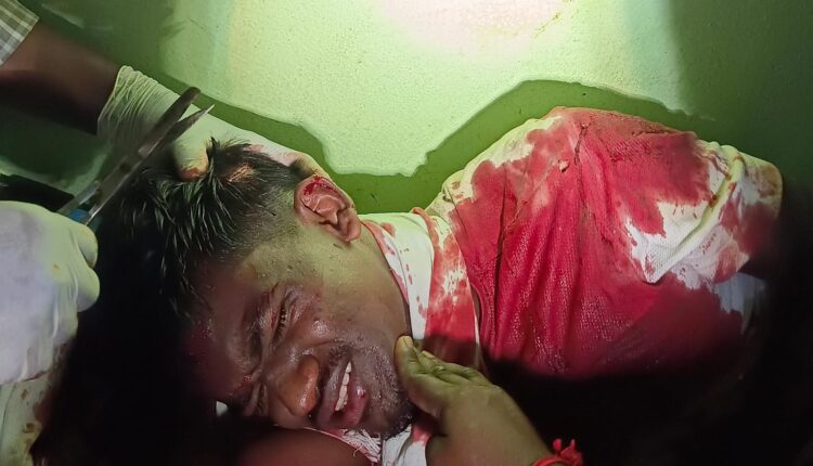 RTC Bus - Bike Collision.. Youth seriously injured