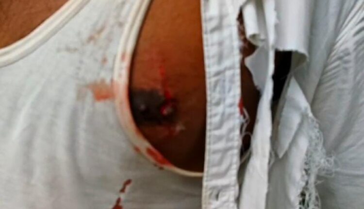 Ten people were bitten by one dog